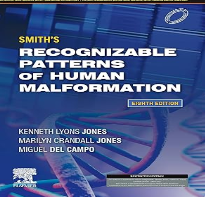 Smith's Recognizable Patterns of Human Malformation